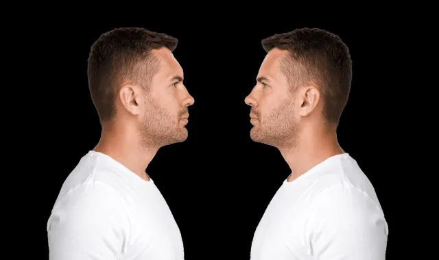 How To Prepare For Brow Bone Reduction Surgery